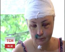 Зґвалтовану у Врадіївці Крашкову від смерті врятувало лише диво Зґвалтовану у Врадіївці Крашкову від смерті врятувало лише диво