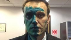 Навальний заявляє, що поліція навмисно не розслідує напад на нього Навальний заявляє, що поліція навмисно не розслідує напад на нього