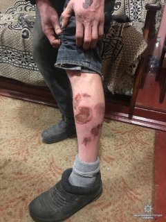 На Кіцманщині чоловік катував свого односельчанина На Кіцманщині чоловік катував свого односельчанина